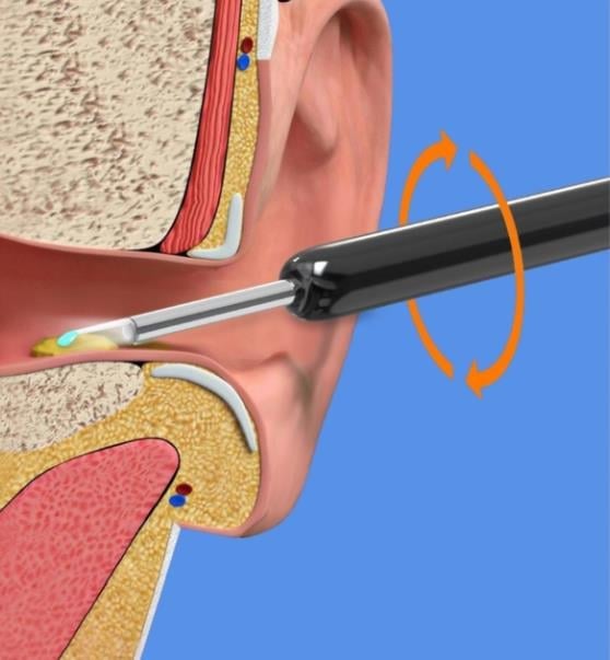 🔥Wireless WIFI Visual Ear Pick 👉🏻Buy expensive package with compensation